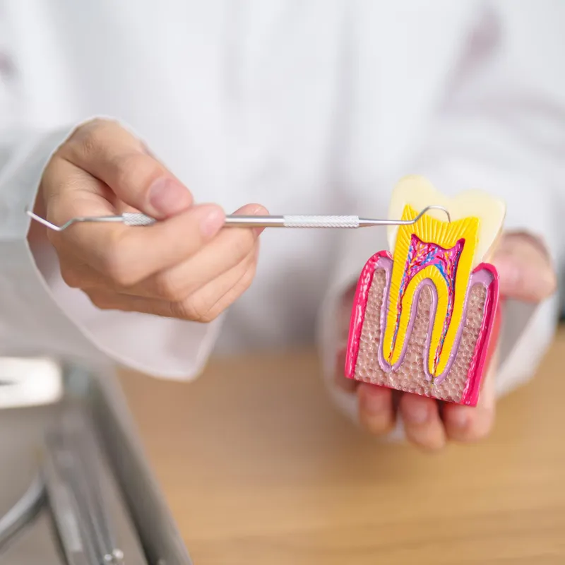 Root Canal Treatment in Bursa